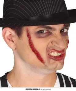 Cicatrice Points De Suture